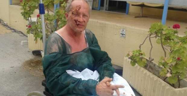 Παρέμβαση Μάκαρη για το μακάβριο κατάλογο του φετινού Πάσχα με τις κροτίδες