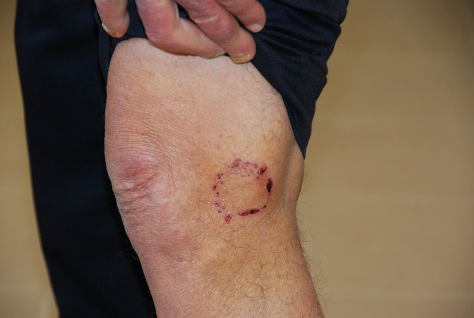 Επιθετικότητα σκύλων