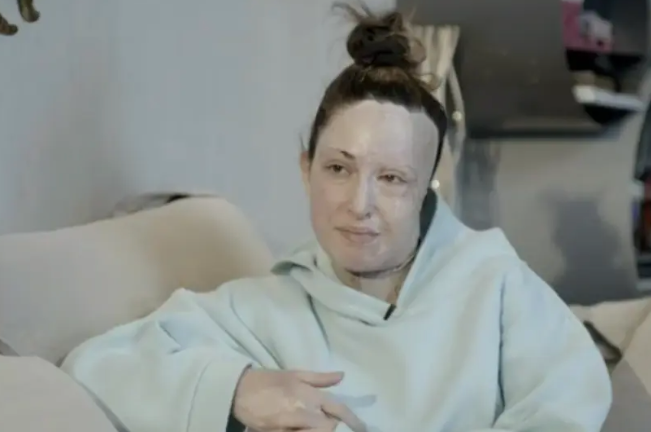 Η Ιωάννα Παλιοσπύρου έδειξε το πρόσωπό της και περιέγραψε τις δραματικές στιγμές της επίθεσης με βιτριόλι